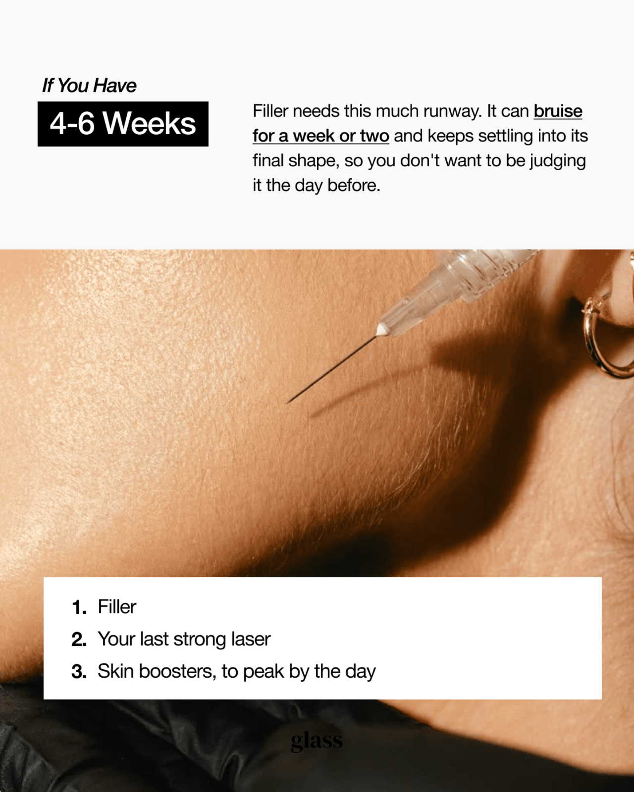 Pre-event treatment timeline at four to six weeks: filler and clinician-planned final laser or skin-booster appointments
