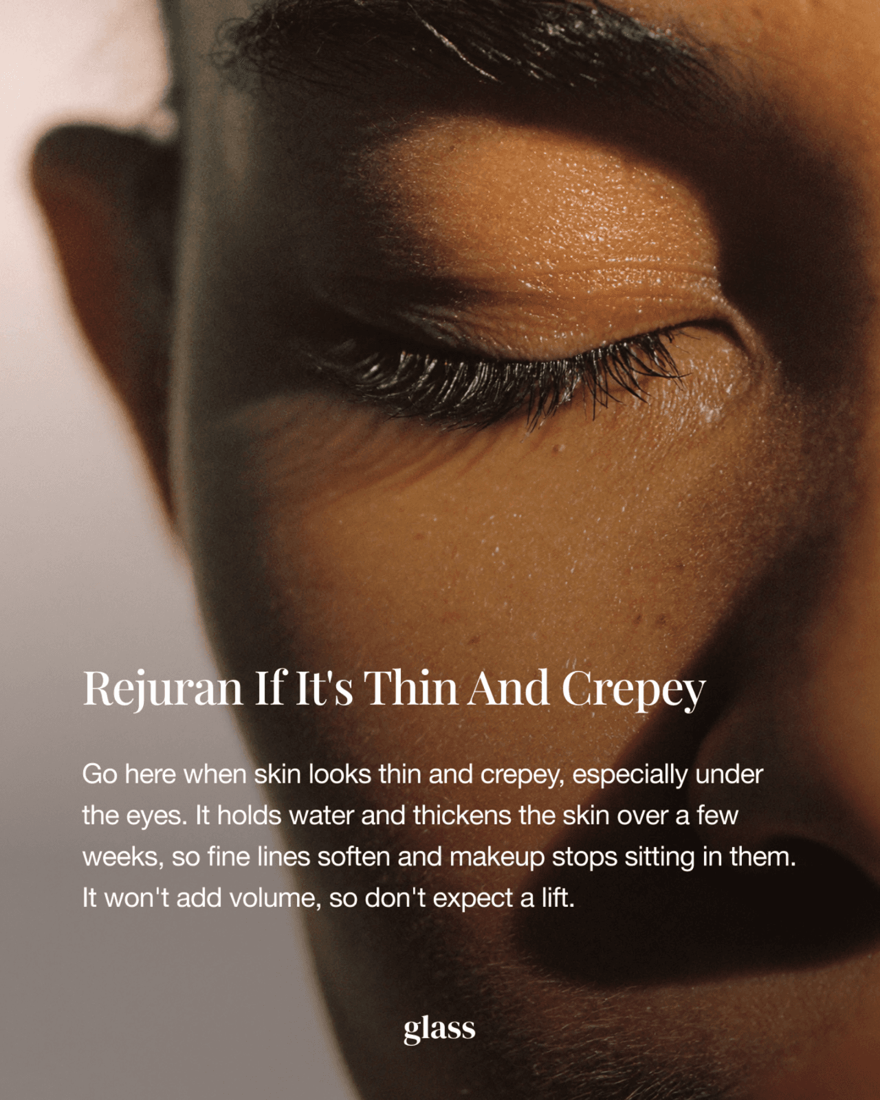 Rejuran polynucleotide skin booster for thin, crepey skin under the eyes